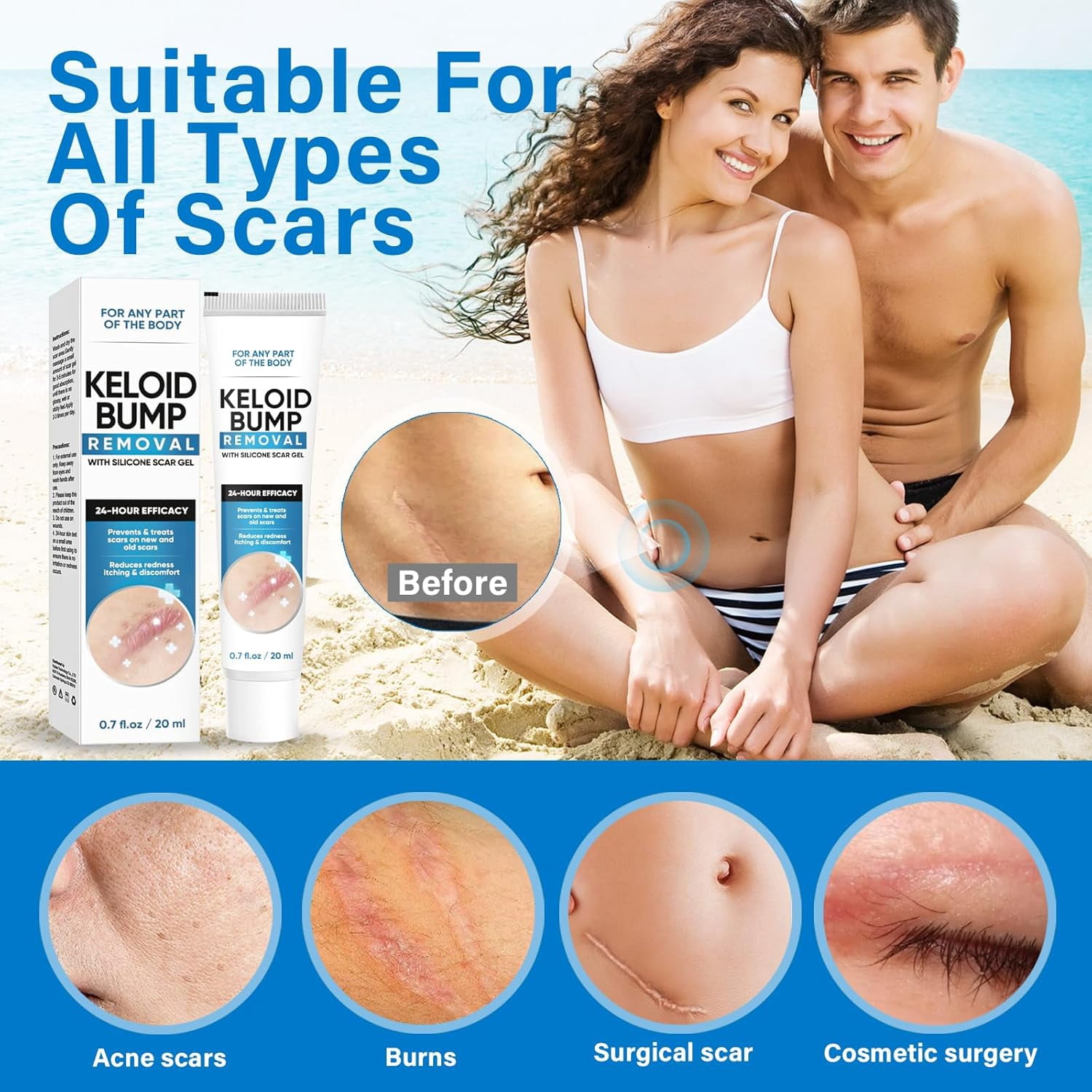 Keloid Bump Removal Gel. Silicone Scar Treatment - Professional Scar Cream for Old & New Scars - 20ml