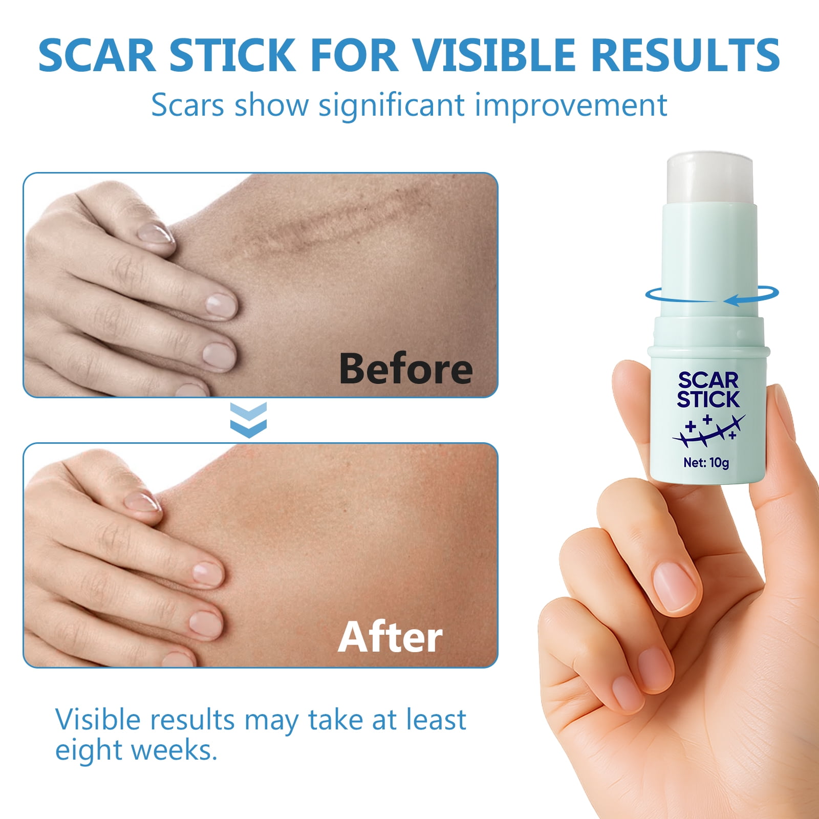 Silicone Scar Stick, Silicone Scar Sheets for Surgical Scars, Stretch Marks Removal, For Face and Body, 10g
